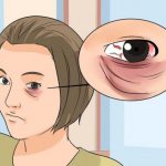 1595765 - How to cover up dark circles under the eyes with cosmetics