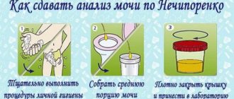 Urinalysis according to Nechiporenko