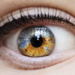 What is heterochromia of the eyes