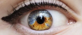 What is heterochromia of the eyes