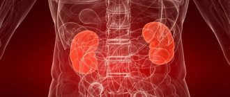 What does microurolithiasis of the left, right or both kidneys mean?