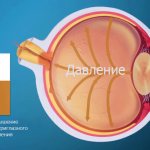 Pressure in glaucoma