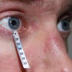 dry eye diagnosis