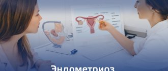 Endometriosis treatment in Yekaterinburg.jpg