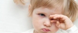Chalazion in a child: how to treat and prevent its occurrence