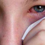 eye drops that relieve swelling