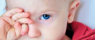 Drops for conjunctivitis for children from one year old, 2-5 years old, with an antibiotic. List of the best: Levomycetin, Tobrex 