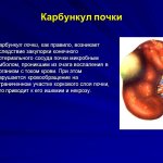 kidney carbuncle