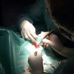 Cataract surgical treatment (operation)