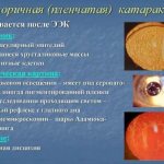 Clinical picture of secondary cataract