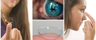 Contact lenses - choice for myopia