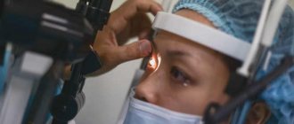 Treatment for an acute attack of glaucoma