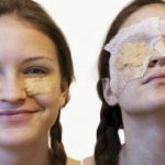 Potato masks for bruises and bags under the eyes
