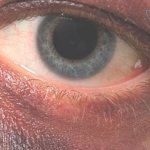 Don&#39;t get dark: TOP 10 folk ways to remove circles under the eyes