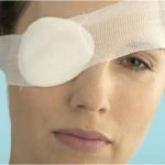 Memo to a patient with glaucoma for rehabilitation: recovery and limitations after surgery