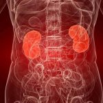 Kidney stone disease: treatment according to Ayurveda