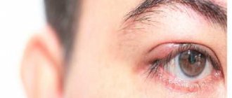 Blown eye - symptoms, treatment