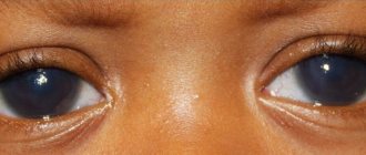 Antiglaucoma eye drops