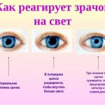 Dilated pupils. The woman’s reasons, the photo, which they constantly talk about, are very large 