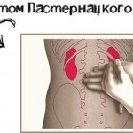 Pasternatsky&#39;s symptom (effleurage). What is it, positive, negative, how to treat 