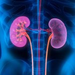 Renal sinus cysts: what are they?