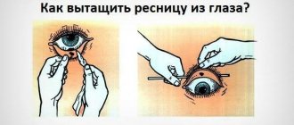 A way to remove an eyelash or speck from an eye