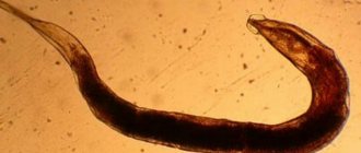 Trichinella and roundworms