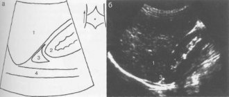 Ultrasound of the right adrenal gland, longitudinal scanning