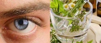 There is mucus in the eyes. Features of treatment 
