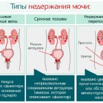 types of urinary incontinence in men
