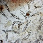 Возбудитель демодекозного блефарита - клещ демодекс под микроскопом