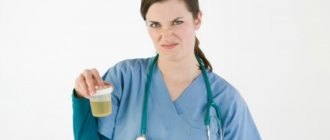 doctor holding a jar of urine