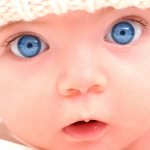 Congenital nystagmus in children