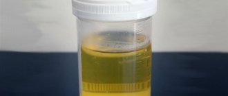 Discharge in urine