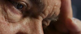 Posterior capsular cataract in an elderly man